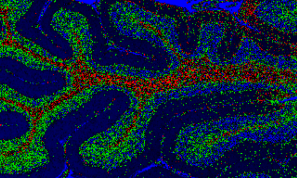 Beyin hücresinin Raman görüntüsü